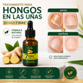 Tónico Jengibre Uñas Antifúngico 7 Days